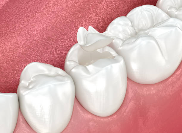 Best Dental Studio in Santa Venetia, CA